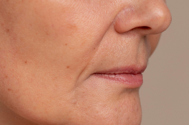 finelines - dr anne skincare