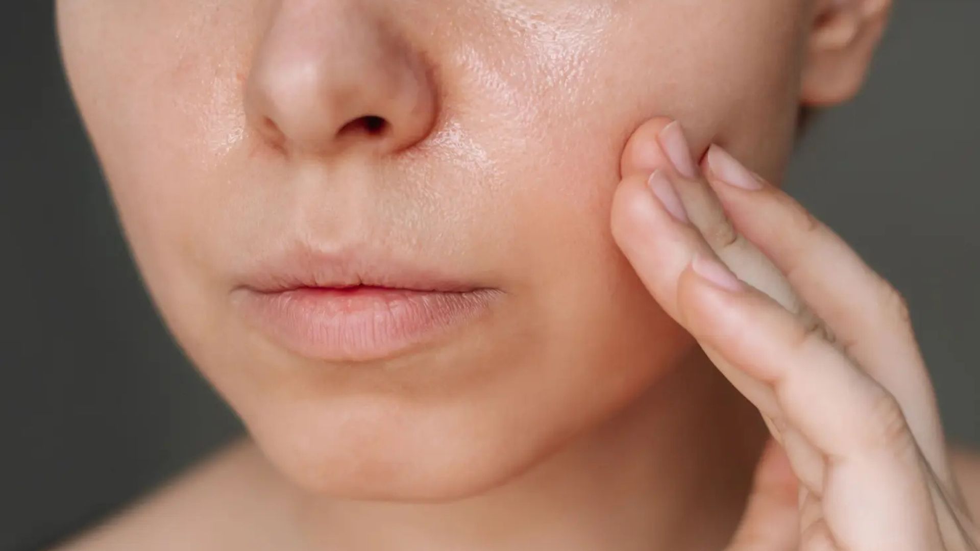 oily skin oily skin - dr anne