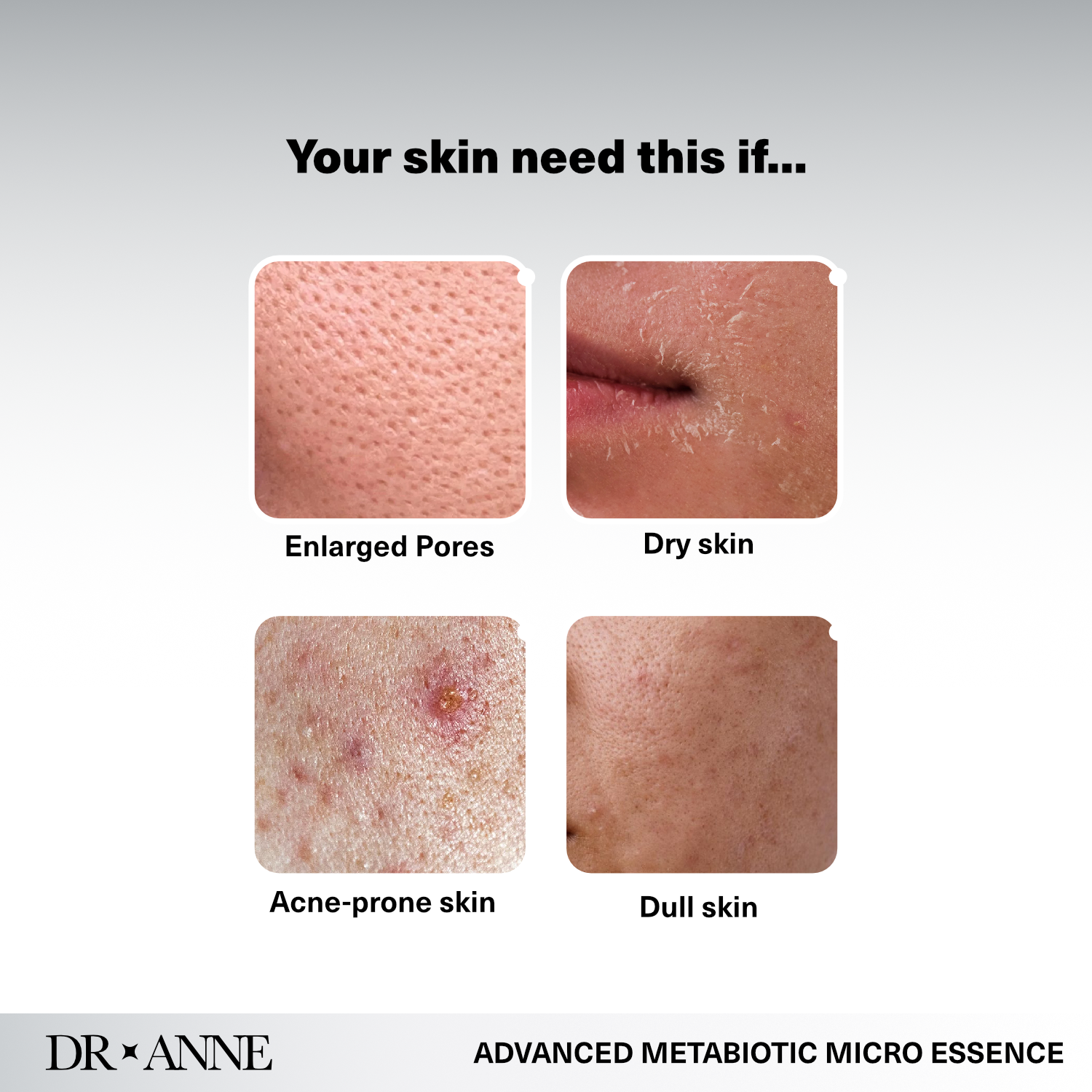 Advanced Metabiotic Micro Essence - Image 3